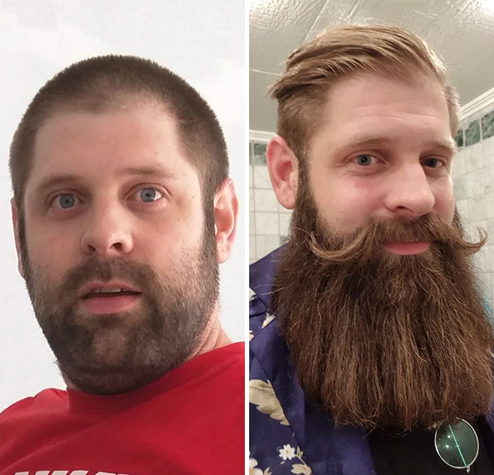 12. Skägg kan vara ett smart sätt att gömma dubbelhakan