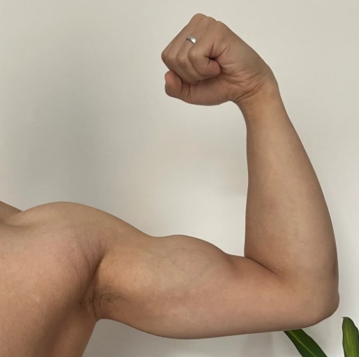 2. Min man har en hjärtformad ven på bicepsen