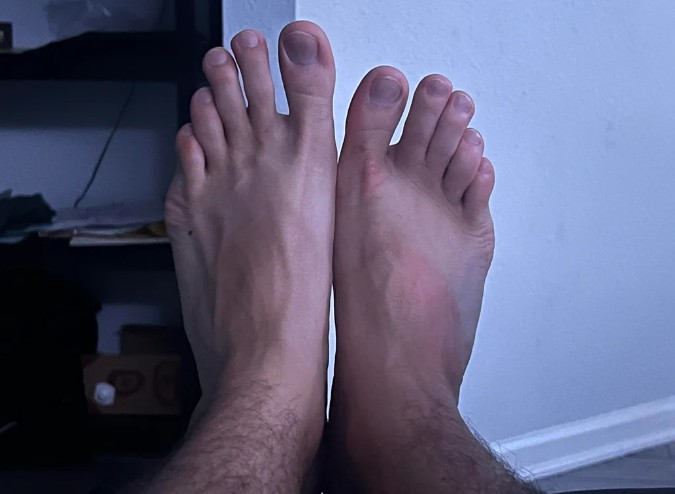 3. Min vänstra fot är mycket större än min högra fot.