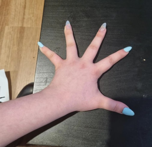 5. Så här kan jag sprida mina fingrar.