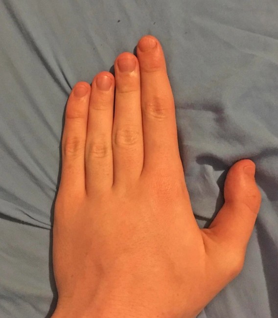 7. Mina trappfingrar